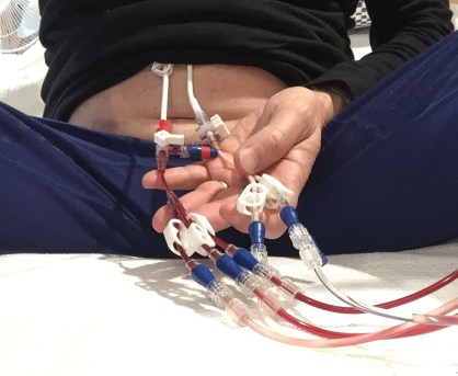 Day 24 Full house on hte Hickman lines